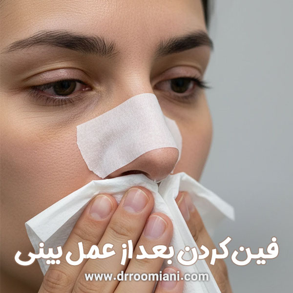 فین کردن بعد از عمل بینی + دکتر مریم رومیانی