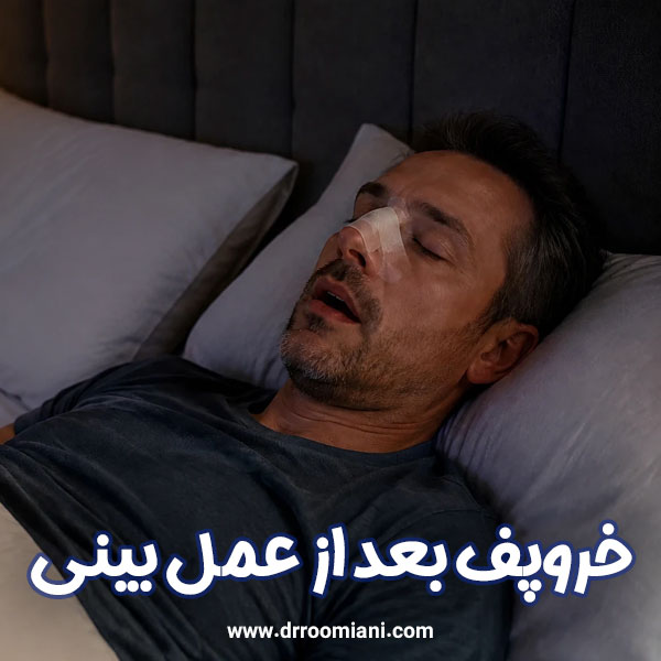 خروپف بعد از عمل بینی + دکتر مریم رومیانی