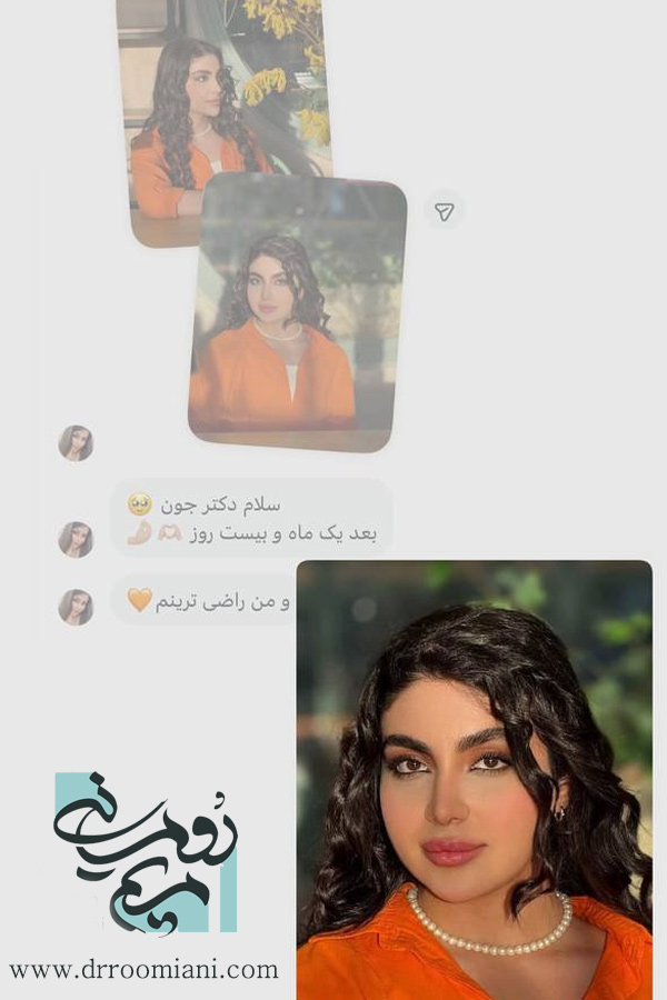 نظرات درباره دکتر مریم رومیانی بهترین جراح بینی تهران