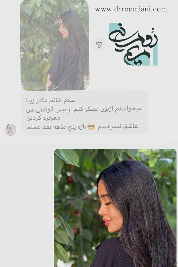 نظرات درباره دکتر مریم رومیانی بهترین جراح بینی تهران