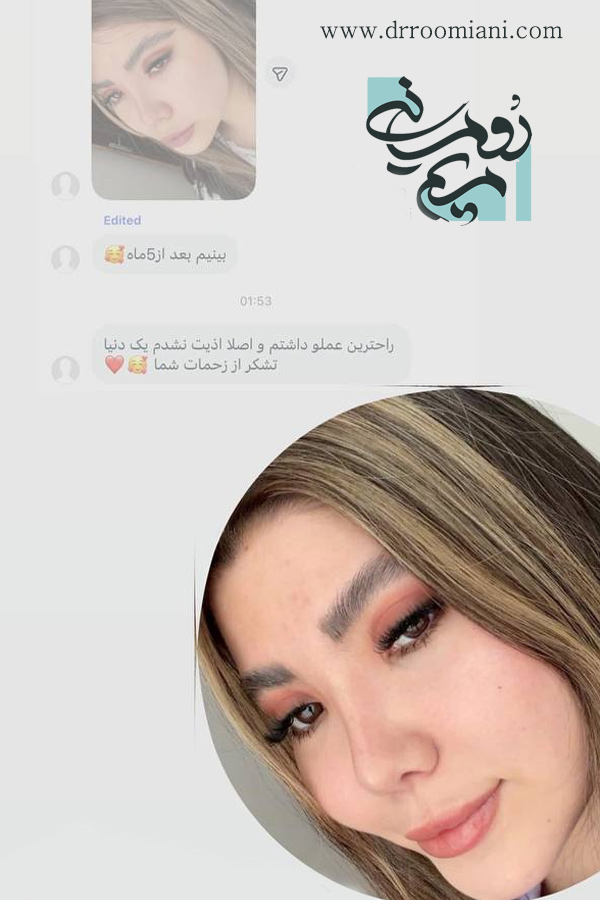 نظرات درباره دکتر مریم رومیانی بهترین جراح بینی تهران