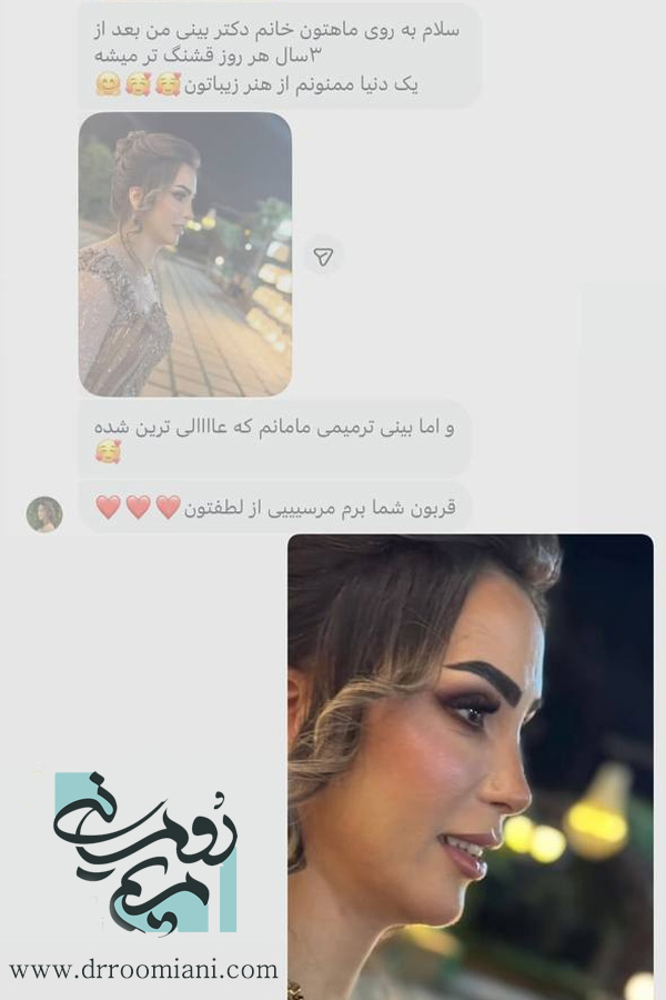 نظرات درباره دکتر مریم رومیانی بهترین جراح بینی تهران