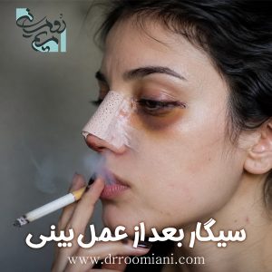 سیگار بعد از عمل بینی + دکتر مریم رومیانی