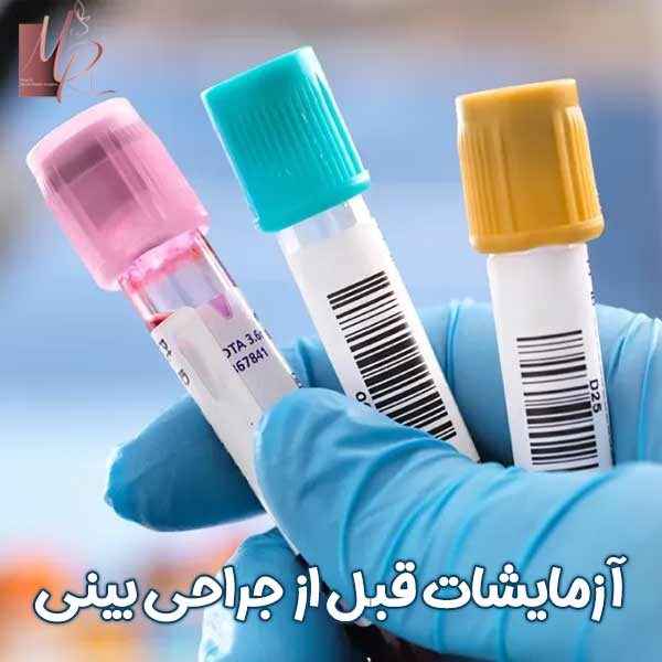 آزمایشات قبل از جراحی بینی - دکتر مریم رومیانی